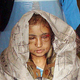 Image for article titled 15-Year-Old Afghan Girl Tortured By In-Laws